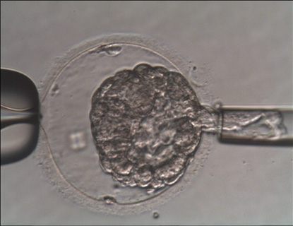 배아 확장 정도에 따른 착상 전 유전검사(PGT-A) 결과 비교 분석 이미지
